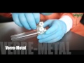 Glass-metal assembly